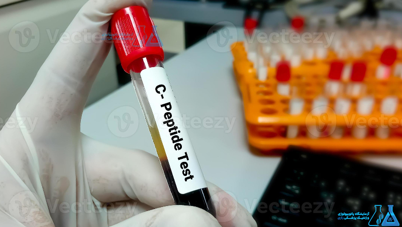 آزمایش C-Peptide