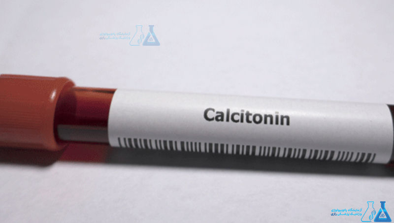 ازمایش Calcitonin