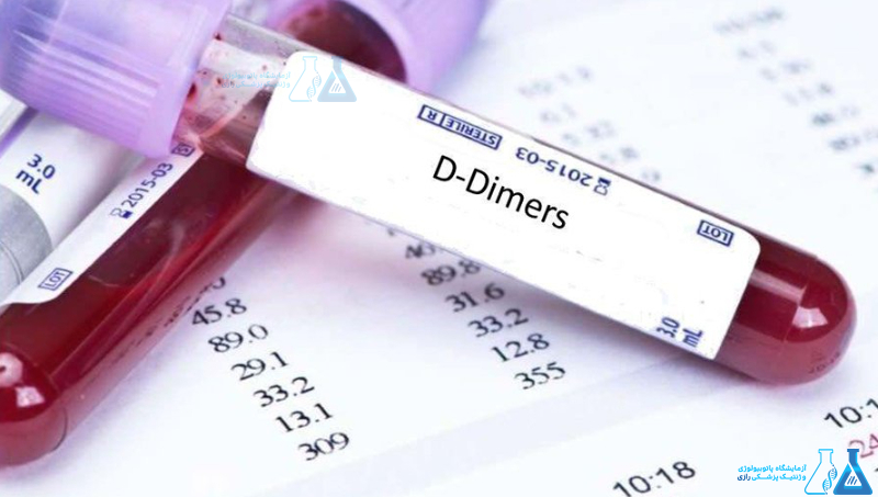 آزمایش d-dimer