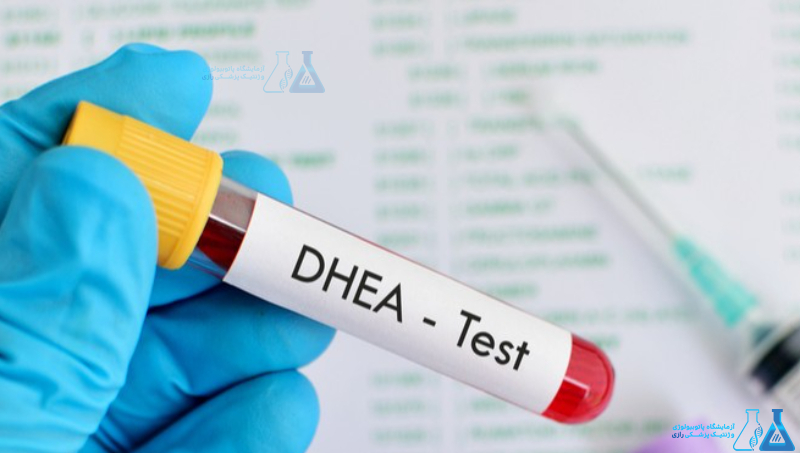 آزمایش DHEA-SO4